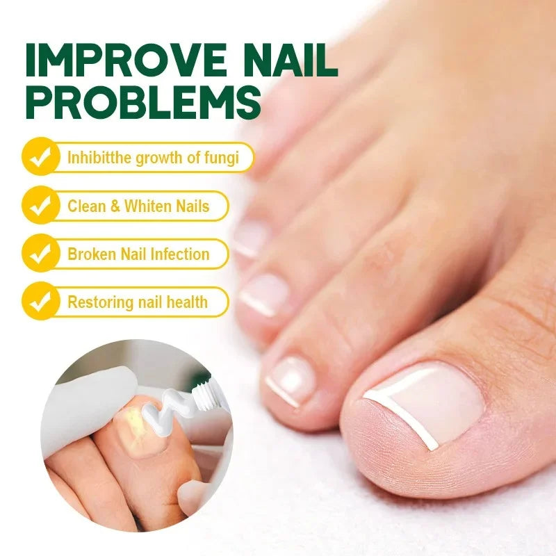 Fungal Nail Treatment Cream