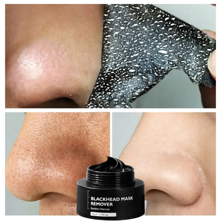 Charcoal Blackhead Remover Mask