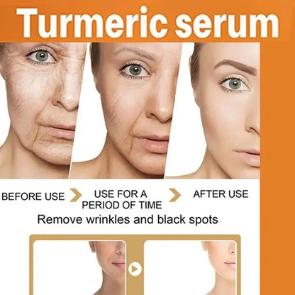 Turmeric Serum For Face And Body