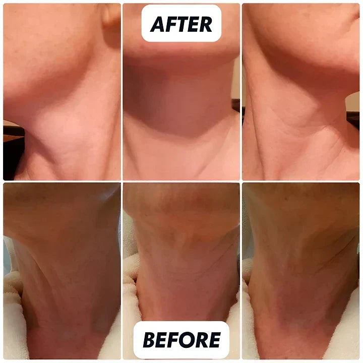 Retinol Collagen Neck Cream